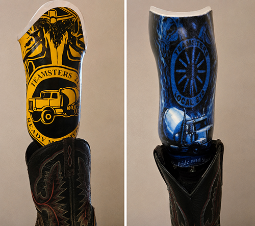 Nick Orford has two prosthetic legs; one for work and one for the rest of his life. Work boots require a specific kind prosthetic design. He proudly chose to have the Teamsters logo emblazoned on his work prosthetic.